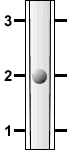 Ball flowmeter